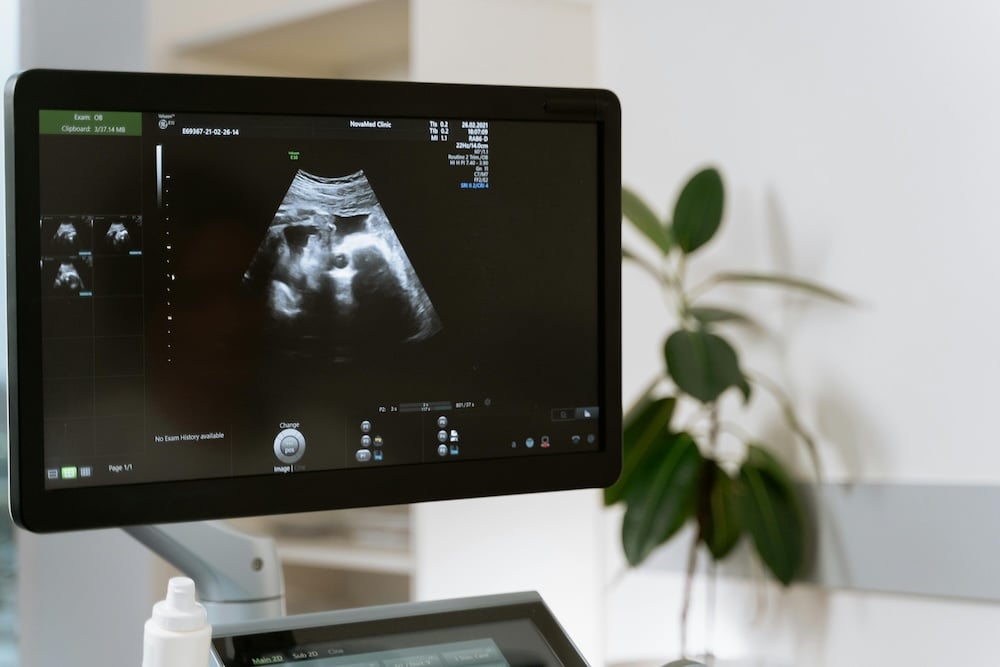 giving birth in japan as a foreigner